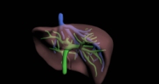 肝脏3d模型带血管图片